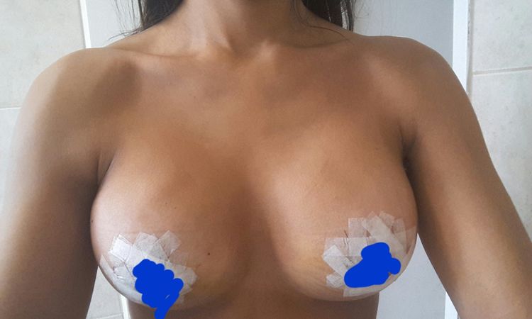 8131