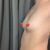 15/8/23 Aumento de mamas 300 cc Dr Leandro Di Carlo