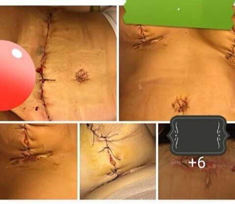 5593