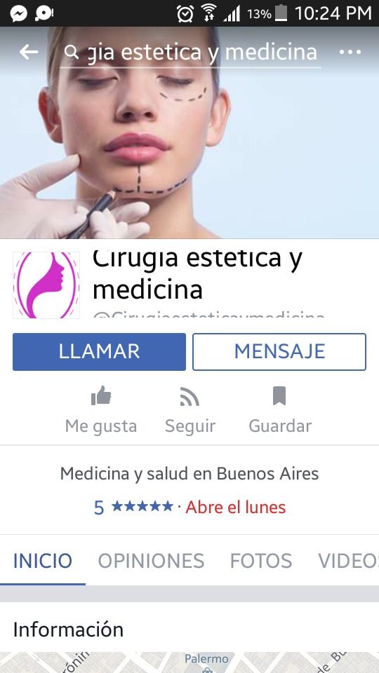 518