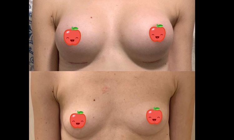 10391