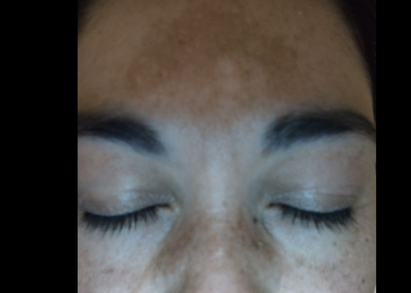 Melasma cosmelan, precio y eficacia?, NataliaSanchez16, sept 2021