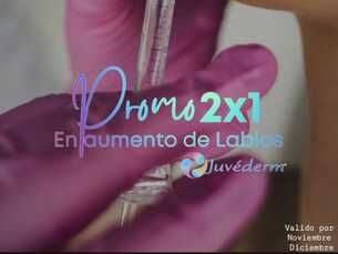 Promo 2 x1  en aumento de labios