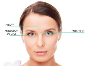 Bótox y rellenos super promo. Sin arrugas