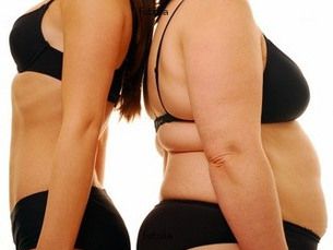 30% off descuento en tu abdominoplastia