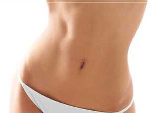 Abdominoplastia