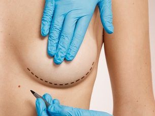 Promo 25% en el total de la cirugía