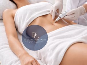 20% Carboxiterapia 🔥