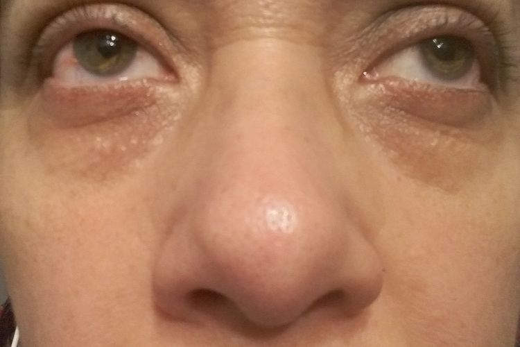 Tratamiento facial
