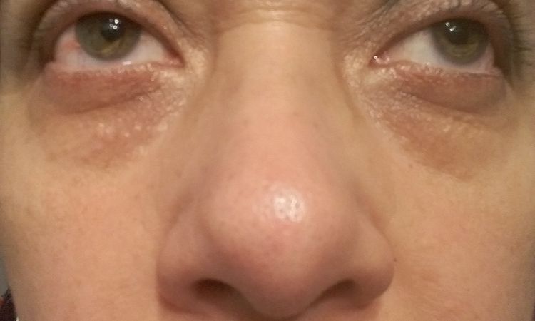 Tratamiento facial - 2838