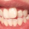 Ortodoncia u operación - 5378