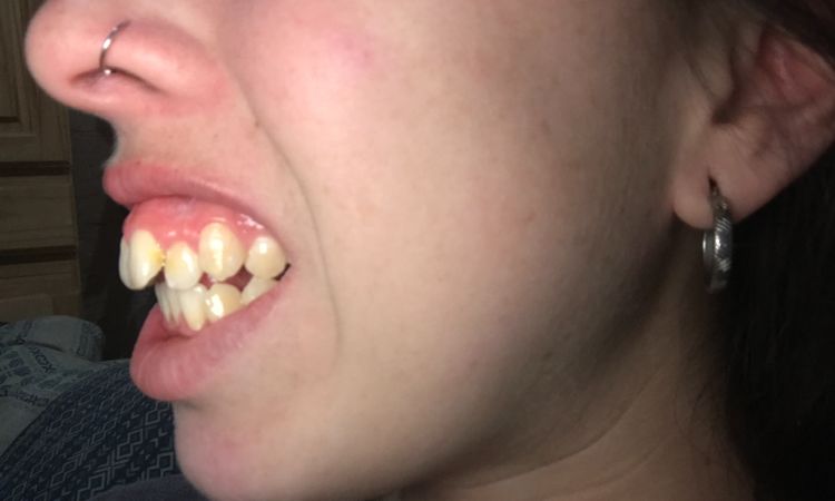 ¿Es posible que me diagnostiquen cirugía maxilofacial sin haberme hecho placas? - 16151