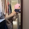 Piel colgante tras mastopexia