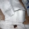Se me abrió la herida ? O es solo sangre