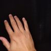 Engrosar dedos de manos - 73959