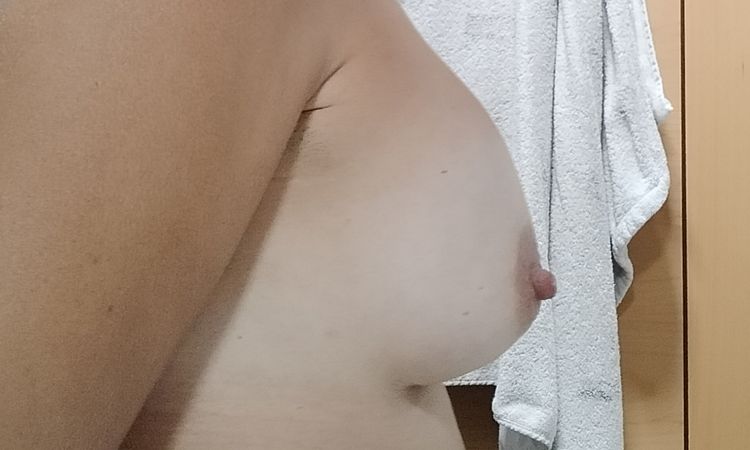 Implante alto 6 meses - 82285