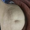 Tratamiento para panza súper arrugada después de embarazo