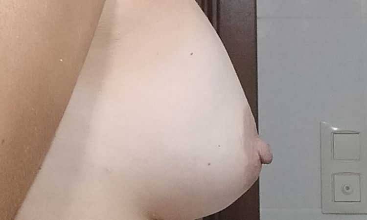 Preocupada pecho raro - 82468