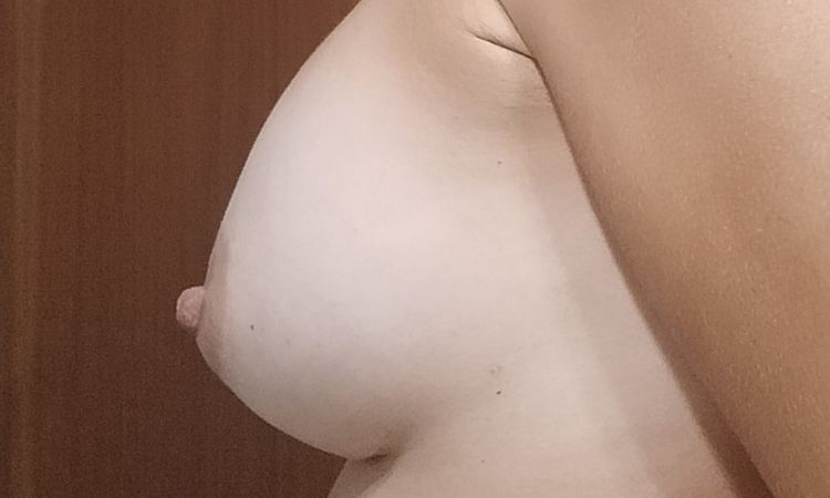 Preocupada pecho raro - 82469