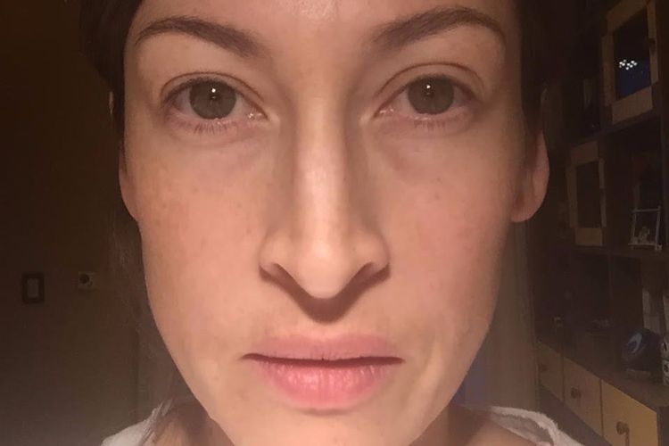 Eliminar manchas en rostro