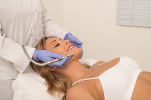 Aplicación del tratamiento de peeling.