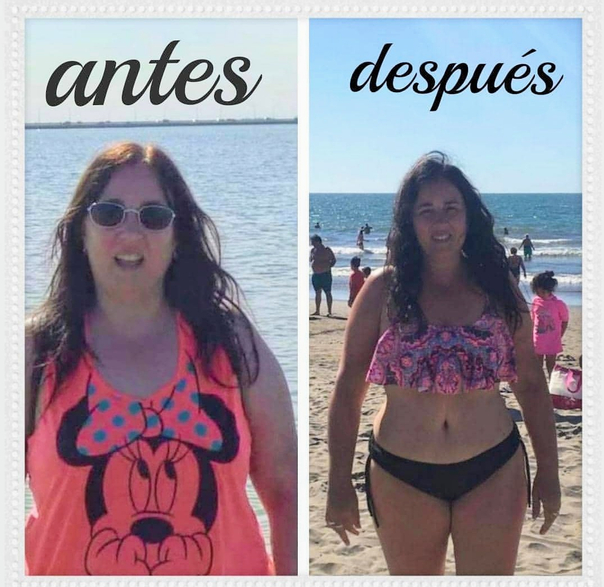 Antes y después de la perdida de peso.