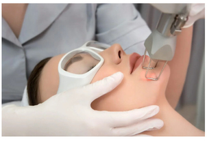 Técnicas para quitar lunares