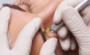 Tratamiento de microblading en cejas