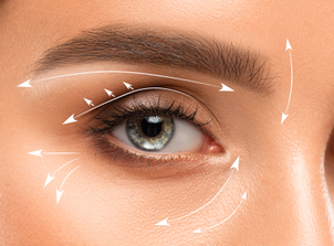 ¿Cuáles son los resultados de la blefaroplastia sin cirugía?