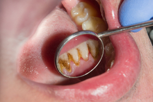 La visita al dentista debe ser anual