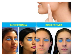 Cómo es la cirugía