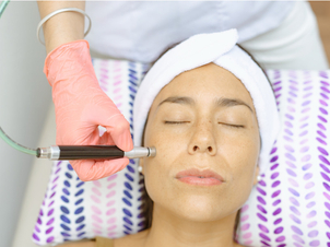 Tratamiento de microdermoabrasión.