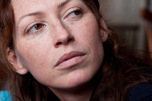 Causas de la aparición de manchas en la piel.