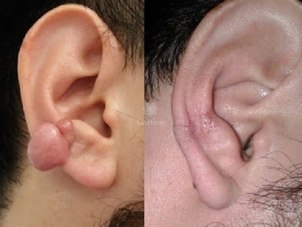 Antes y después del tratamiento