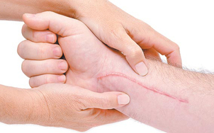 Examinar la cicatriz