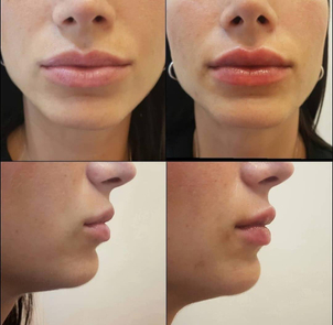 Observación de la anatomía de los labios