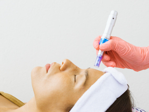 Tipos de tratamiento de peeling.