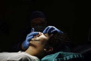 El procedimiento de la rinoplastia secundaria