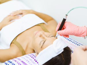 Tratamiento de microdermoabrasión.