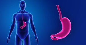 Complicaciones del tratamiento bariátrico
