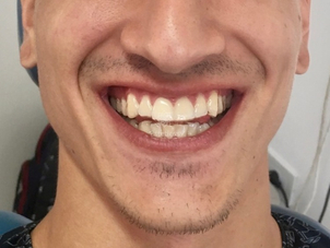 Paciente de periodoncia