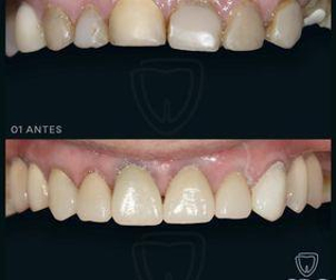 Durante la primera consulta