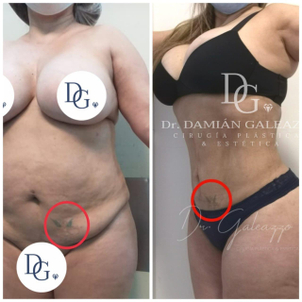 Masajes posquirúrgicos