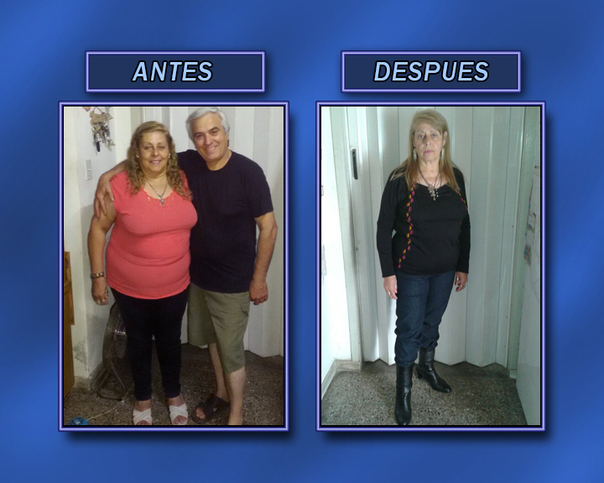 Antes y después de un régimen para perder de peso. 