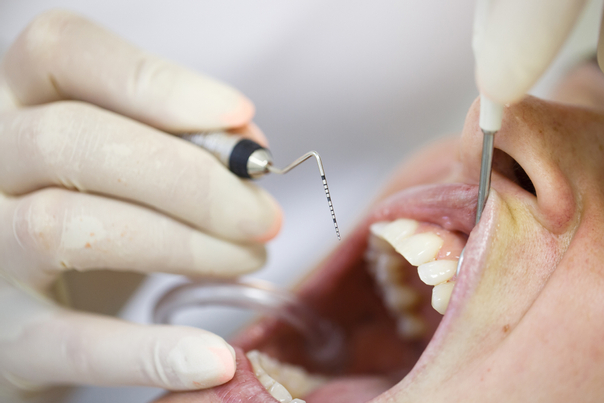 las encías inflamadas, las caries dentales, y la pérdida de piezas dentarias son algunos de los principales problemas de una salud bucal deficiente