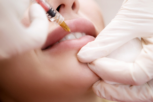 ¿Cuándo se recomienda el uso de hialuronidasa?