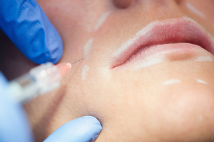 Tratamiento facial en la transición de sexo