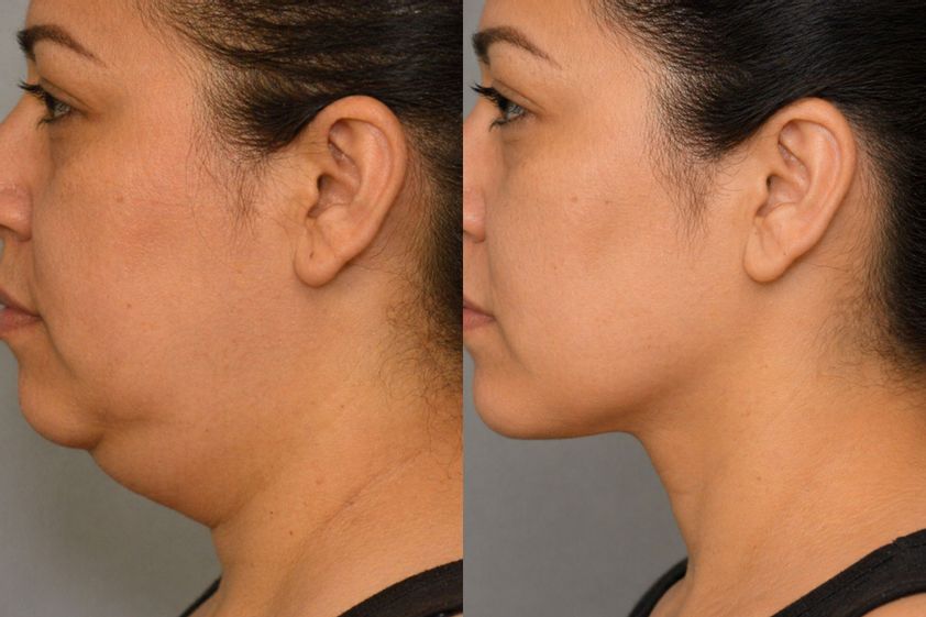Lipopapada