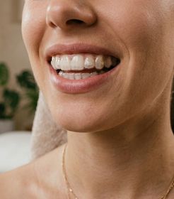 Ortodoncia invisible