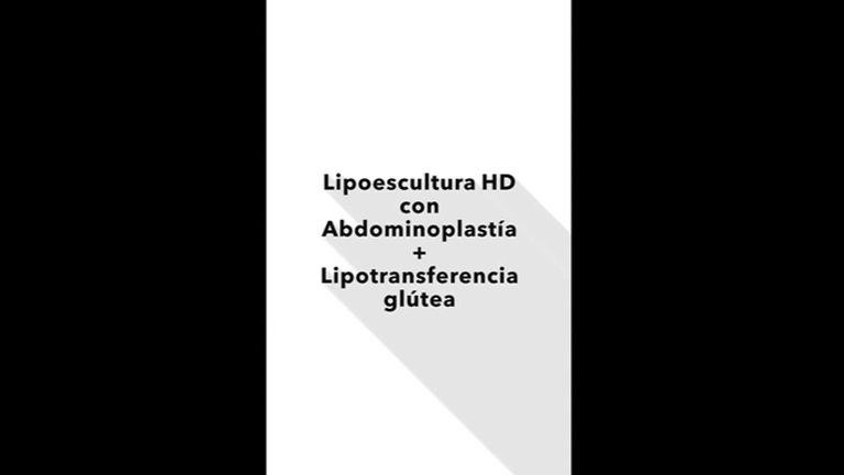 Lipoescultura HD + abdominoplastia + lipotransferencia glútea